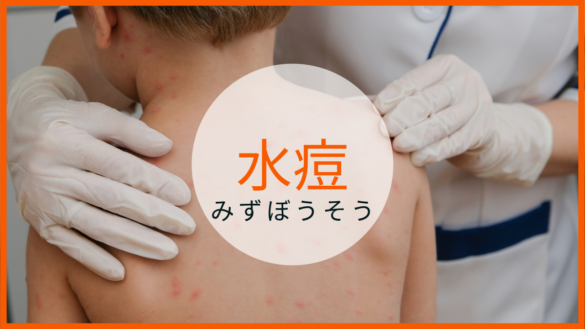 水ぼうそう(水疱瘡、水痘) | おぎくぼ小児科